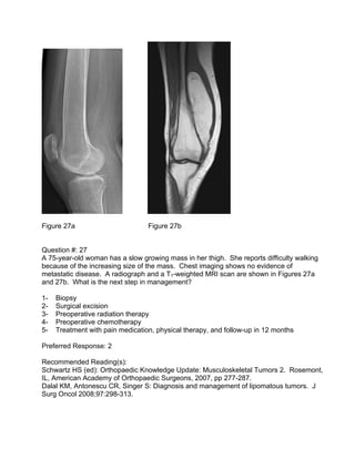 Figure 27a                        Figure 27b


Question #: 27
A 75-year-old woman has a slow growing mass in her thigh. Sh...