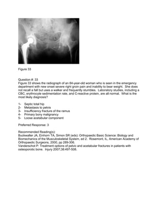 Figure 33


Question #: 33
Figure 33 shows the radiograph of an 84-year-old woman who is seen in the emergency
department ...