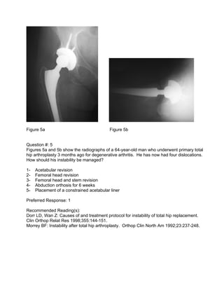 Figure 5a                                  Figure 5b


Question #: 5
Figures 5a and 5b show the radiographs of a 64-year-o...
