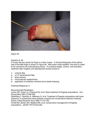Figure 48


Question #: 48
A 4-year-old boy injures his finger in a lawn mower. A clinical photograph of the palmar
side o...