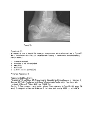 Figure 73


Question #: 73
A 35-year-old man is seen in the emergency department with the injury shown in Figure 73.
Reduc...