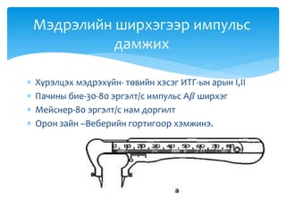  Хүрэлцэх мэдрэхүйн- төвийн хэсэг ИТГ-ын арын I,II
 Пачины бие-30-80 эргэлт/с импульс А𝛽 ширхэг
 Мейснер-80 эргэлт/с нам доргилт
 Орон зайн –Веберийн гортигоор хэмжинэ.
Мэдрэлийн ширхэгээр импульс
дамжих
 