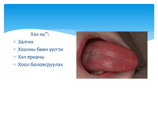 Хэл нь”:
 Залгих
 Хоолны бөөн үүсгэх
 Хэл ярианы
 Хоол боловсруулах
 