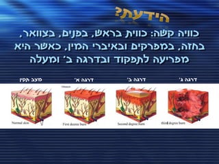 ‫כוויה קשה: כווית בראש, בפנים, בצוואר,‬
‫בחזה, במפרקים ובאיברי המין, כאשר היא‬
   ‫מפריעה לתפקוד ובדרגה ב' ומעלה‬
 ‫מצב תקין‬   ‫דרגה א'‬   ‫דרגה ב'‬           ‫דרגה ג'‬




                                ‫‪third‬‬
 