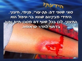 ‫סוגי שטפי דם: תת-עורי, פנימי, חיצוני.‬
   ‫היחידי מביניהם שהוא בר-טיפול הוא‬
‫החיצוני. לכן בכל שטף דם מסכן-חיים נפנה‬
           ‫בדחוף לחדר טראומה.‬
 