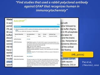 “Find studies that used a rabbit polyclonal antibody
against GFAP that recognizes human in
immunocytochemisty”
Paz et al,
J Neurosci, 2010
(AB_310775)
 