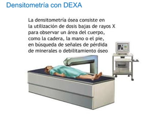 Densitometría con DEXA
 