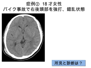 画像ったー頭部 画像ったー頭部