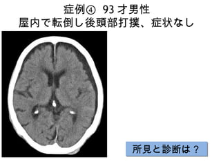 画像ったー頭部