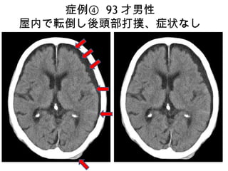 画像ったー頭部