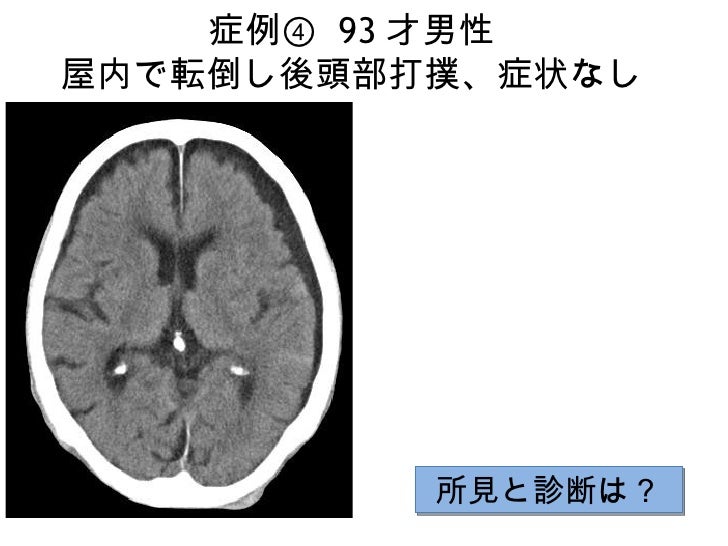 画像ったー頭部 画像ったー頭部