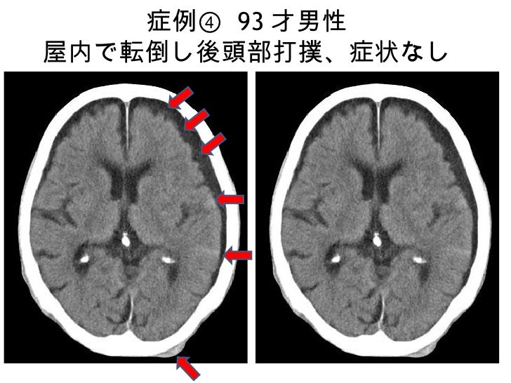 画像ったー頭部 画像ったー頭部
