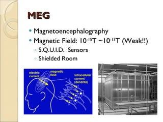 MEG Magnetoencephalography Magnetic Field: 10 -15 T ~10 -13 T (Weak!!) S.Q.U.I.D.  Sensors Shielded Room 