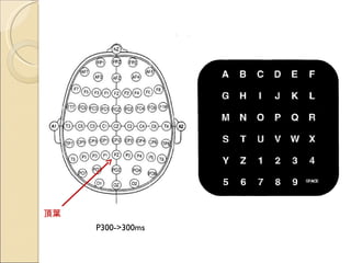 P300->300ms 頂葉 