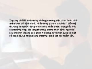 X-quang phổi là  một trong những phương tiện chẩn đoán hình ảnh được chỉ định nhiều nhất trong y khoa. Các bác sĩ điều trị...