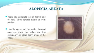 ALOPECIA AREATA
Rapid and complete loss of hair in one
or most often several round or oval
patches.
Usually occur on the scalp, bearded
area, eyebrows, eye lashes and less
commonly on other hairy areas of the
body.
 