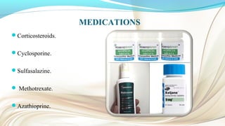 MEDICATIONS
Corticosteroids.
Cyclosporine.
Sulfasalazine.
 Methotrexate.
Azathioprine.
 