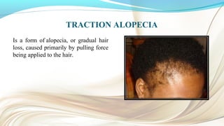 TRACTION ALOPECIA
Is a form of alopecia, or gradual hair
loss, caused primarily by pulling force
being applied to the hair.
 