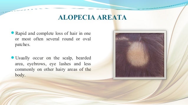 Alopecia