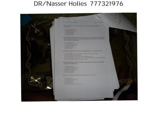 DR/Nasser Holies 777321976
final written bxam. - orthop NOV 5010 PAl'
tH I
1 Which of the following bone luniors has u "thicken wire iippcar«ncf" iMF t
I'acUgrounil;
A. Ancurysmal bone cyst
B.
Unicamcral bone cyst
C.
Fibrous dysplasia
D, Chondroblastoina -
E. Ewings sarcoma
2.
Which oflhc rollowing luniors is known lo occur, most commonly in Ihc Ursl and
second decades, and involves most commonly the epiphysis and in its matrix has
small splculu of calctflcation;
A. Chondroblastoma <
B. Eosinophilic granuloma
C.
Unicamerul bone cyst
D.
Giant cell lumor
E.
Ostcosarcoma
3.
Which of Ihc following slatemcnls dues NOT apply lo an oslcuchondromu:
A. The medullary cavity is conlinuous with that oflhc bone of origin
B.
May be sessile or pcdunculated
C. Grows along the line of pull of the surrounding muscles
L D.Usually undergoes metaplasia prior to the termination of growth of the individual
E.
Is located in the meluphyscal region of bone
4. An osteochondroma with a carlilaginous cap thicker than 2cnis and is painful
should be investigated for:
A.
Tendon snapping
B.
Maligiuinl Iransformalion
C.
Nerve root irritation
D. Pseudo-ancurysm
E.
Pseudo-fraclures
5.
The most common location of a unicameral bone cysl, is in the:
A. The diaphysis
B, The humerus and femur
C. Innominate bone
D. Vertebral body
E.
Posierior arches of the vertebrae
 