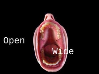 Open
Wide
 