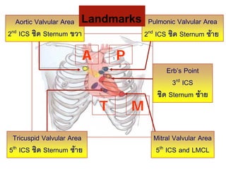 Erb’s Point
3rd ICS
ชิด Sternum ซาย
Mitral Valvular Area
5th ICS and LMCL
Tricuspid Valvular Area
5th ICS ชิด Sternum ซาย
Aortic Valvular Area
2nd ICS ชิด Sternum ขวา
Pulmonic Valvular Area
2nd ICS ชิด Sternum ซาย
A P
MT
Landmarks
 
