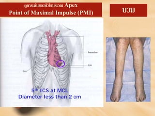 ดูการเตนของหัวใจบริเวณ Apex
Point of Maximal Impulse (PMI)
5th ICS at MCL
Diameter less than 2 cm
บวม
 