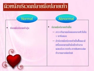 ผิวหนังบริเวณปลายมือปลายเทา
• ปลายมือปลายเทาอุน • ปลายมือปลายเทาเย็น
– ภาวะปริมาณเลือดออกจากหัวใจใน
1 นาทีลดลง
– ถาปลายมือปลายเทาเย็นชื้นและมี
เหงื่อออกตามฝามือฝาเทาอาจ
แสดงถึงระบบประสาทซิมพาเธติค
ทํางานมากผิดปกติ
Normal Abnormal
 