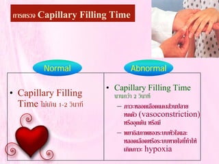 • Capillary Filling
Time ไมเกิน 1-2 วินาที
• Capillary Filling Time
นานกวา 2 วินาที
– ภาวะหลอดเลือดแดงสวนปลาย
หดตัว (vasoconstriction)
หรืออุดตัน หรือมี
– พยาธิสภาพของระบบหัวใจและ
หลอดเลือดหรือระบบหายใจที่ทําให
เกิดภาวะ hypoxia
Normal Abnormal
การตรวจ Capillary Filling Time
 