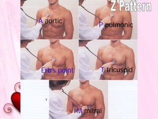 A aortic
P pulmonic
T tricuspid
M mitral
Erb’s point
 