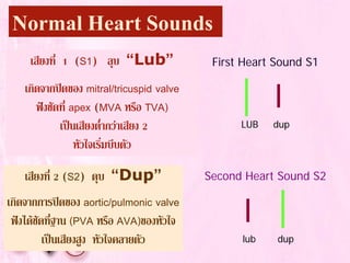 Normal Heart Sounds
First Heart Sound S1
Second Heart Sound S2
เสียงที่ 1 (S1) ลุบ “Lub”
เกิดจากปดของ mitral/tricuspid valve
ฟงชัดที่ apex (MVA หรือ TVA)
เปนเสียงต่ํากวาเสียง 2
หัวใจเริ่มบีบตัว
เสียงที่ 2 (S2) ดุบ “Dup”
เกิดจากการปดของ aortic/pulmonic valve
ฟงไดชัดที่ฐาน (PVA หรือ AVA)ของหัวใจ
เปนเสียงสูง หัวใจคลายตัว
LUB dup
lub dup
 