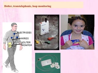 Holter, transtelephonic, loop monitoring
 