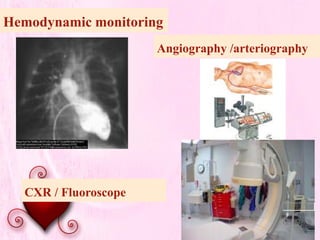 Hemodynamic monitoring
Angiography /arteriography
CXR / Fluoroscope
 