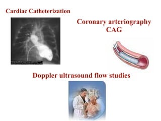 Cardiac Catheterization
Coronary arteriography
CAG
Doppler ultrasound flow studies
 