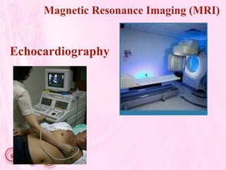 Echocardiography
Magnetic Resonance Imaging (MRI)
 
