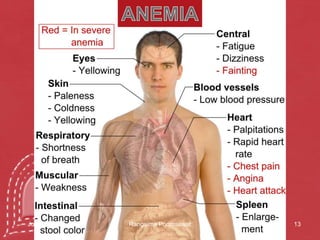 13ANEMIA14 June 2010Rangsima Poomsawat