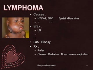 9LYMPHOMACauses : HTLV-1, EBV หรือ Epstein-Barr virus~ โรคเอดส์, ~รับเคมีบำบัด , ~รังสีบำบัดS/Sx : LN โต บวม ตับม้ามโต น้ำหนักลด ซีด เป็นจ้ำLab: BiopsyRx: ReferChemo , Radiation , Bone marrow aspiration14 June 2010Rangsima Poomsawat