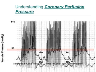 Understanding  Coronary Perfusion Pressure Note this is Aortic Pressure. CPP is “roughly” half Aortic Pressure.  