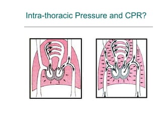 Intra-thoracic Pressure and CPR? 