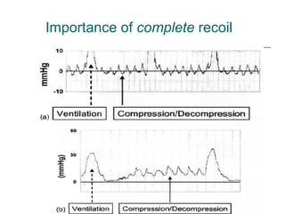 Importance of  complete  recoil 