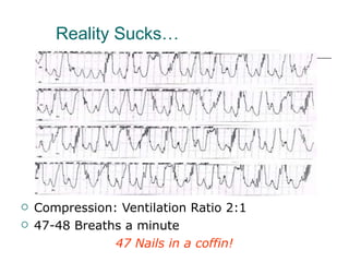 Reality Sucks… Compression: Ventilation Ratio 2:1 47-48 Breaths a minute 47 Nails in a coffin! 