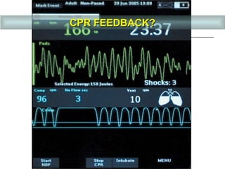 CPR Feedback? CPR FEEDBACK? 
