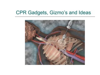 CPR Gadgets, Gizmo’s and Ideas 