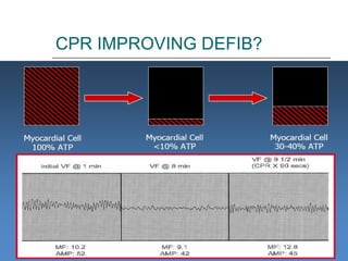 CPR IMPROVING DEFIB? 