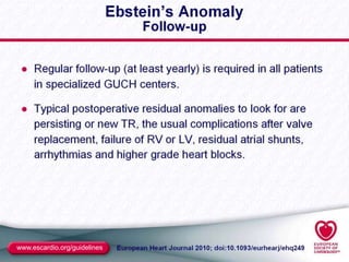 2010 ESC Grown-Up Congenital Heart Disease Guidelines Slide Set.ppt
