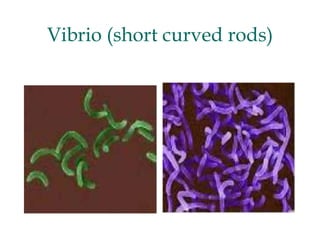 Vibrio (short curved rods)
 