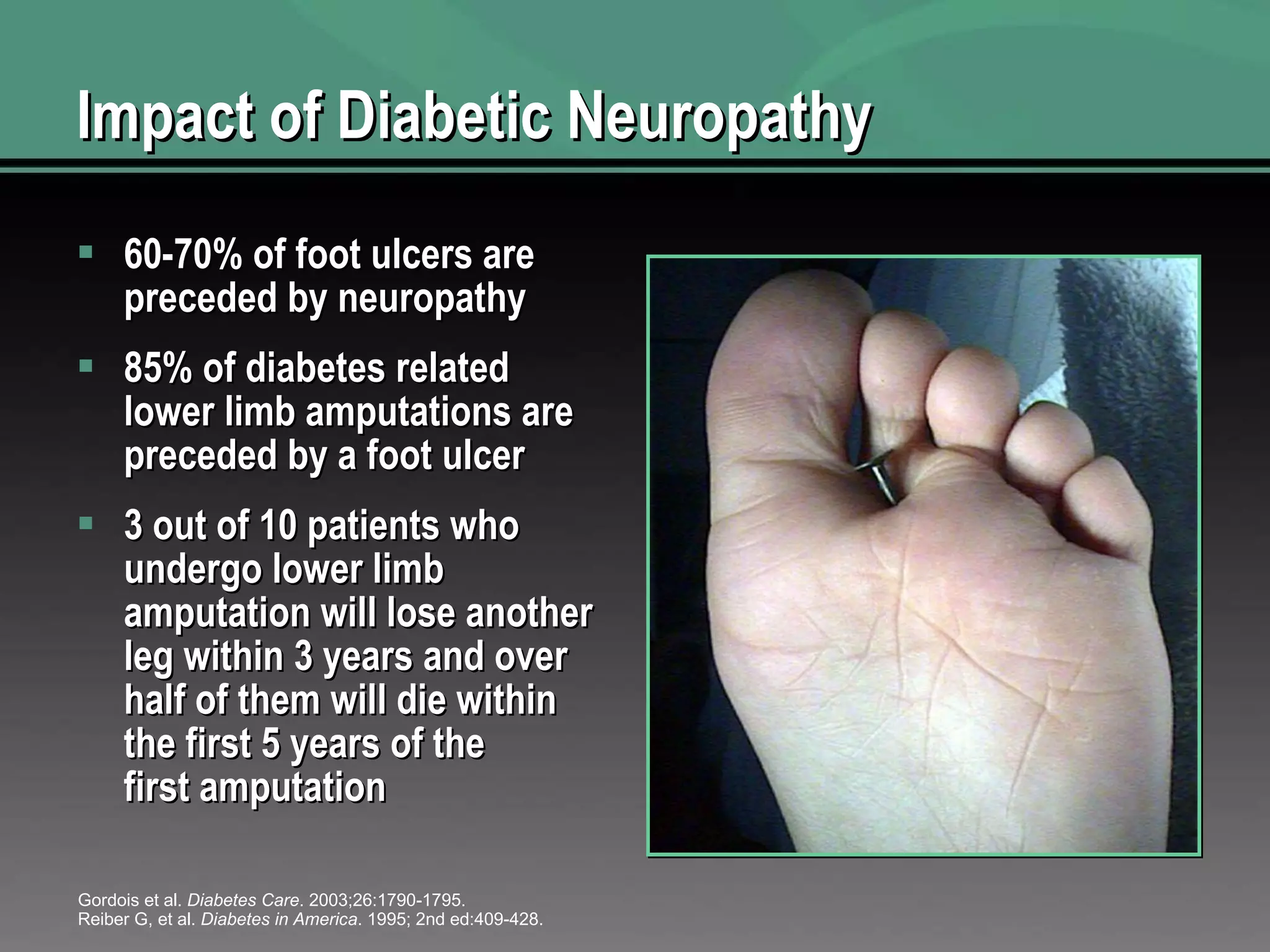 Impact of Diabetic Neuropathy 60-70% of foot ulcers are preceded by neuropathy   85% of diabetes related lower limb amputations are preceded by a foot ulcer 3 out of 10 patients who undergo lower limb amputation will lose another leg within 3 years and over half of them will die within the first 5 years of the first amputation Gordois et al.  Diabetes Care . 2003;26:1790-1795. Reiber G, et al.  Diabetes in America . 1995; 2nd ed:409-428. 