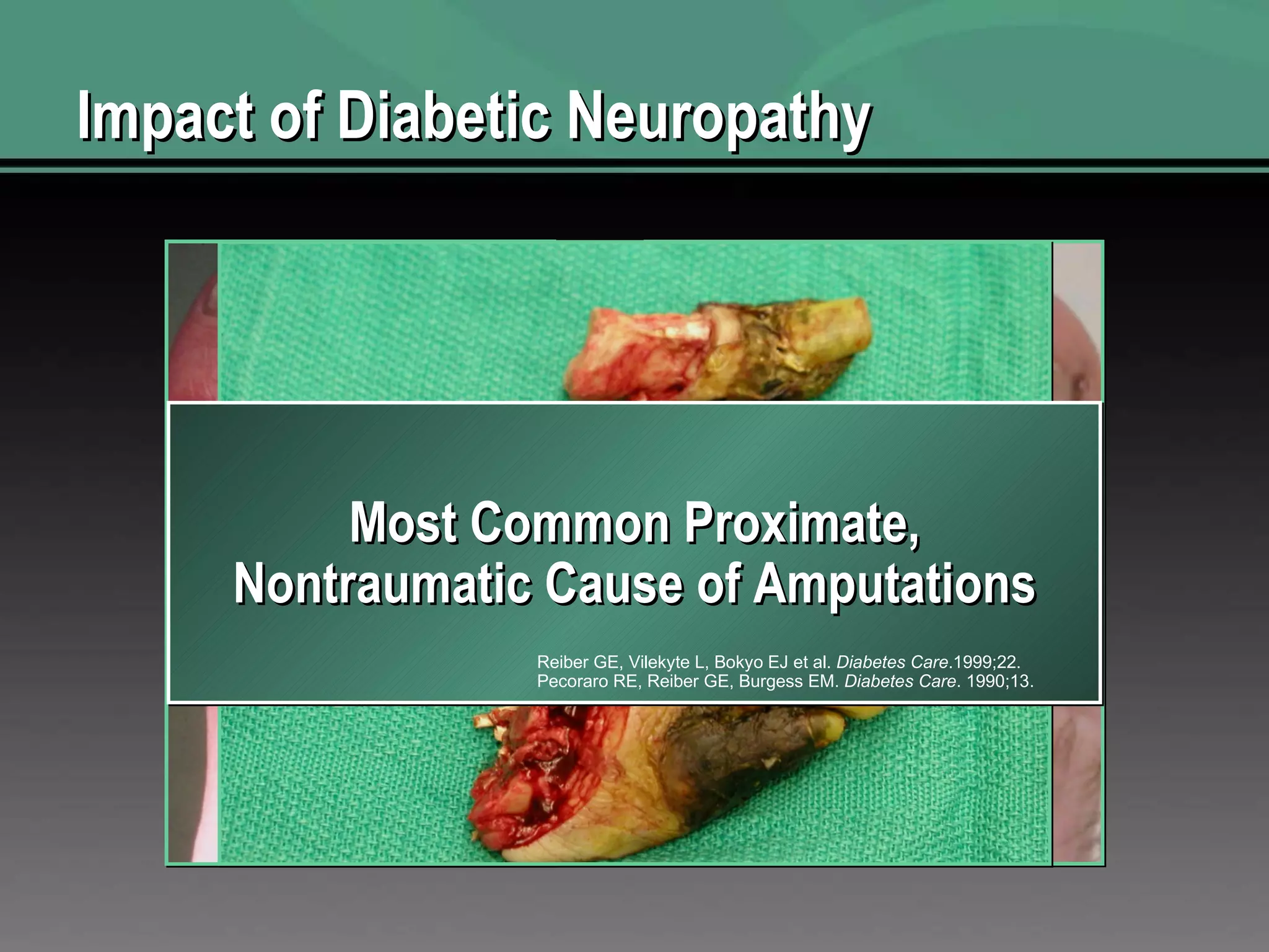 Impact of Diabetic Neuropathy Largest number of diabetes related hospital bed-days Frykberg R, et al.  Journ of Foot and Ankle Surgery  2006;45(5):S2-S8. Most Common Proximate, Nontraumatic Cause of Amputations Reiber GE, Vilekyte L, Bokyo EJ et al.  Diabetes Care .1999;22. Pecoraro RE, Reiber GE, Burgess EM.  Diabetes Care . 1990;13. 