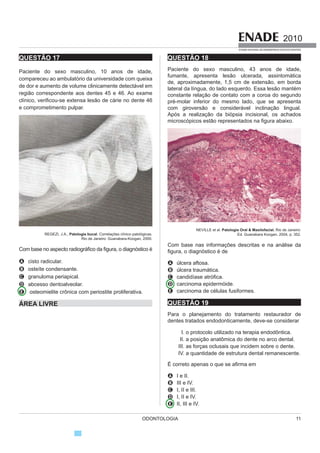 Analisando a relação proposta entre as duas asserções
acima, assinale a opção correta.
A As duas asserções são proposições verdadeiras, e a
VHJXQGD p XPD MXVWL¿FDWLYD FRUUHWD GD SULPHLUD
B As duas asserções são proposições verdadeiras, mas
D VHJXQGD QmR p XPD MXVWL¿FDWLYD FRUUHWD GD SULPHLUD
C A primeira asserção é uma proposição verdadeira, e
a segunda é uma proposição falsa.
D A primeira asserção é uma proposição falsa, e a
segunda é uma proposição verdadeira.
E As duas asserções são proposições falsas.
ÁREA LIVRE
QUESTÃO 8
Isótopos radioativos estão ajudando a diagnosticar
as causas da poluição atmosférica. Podemos, com
essa tecnologia, por exemplo, analisar o ar de uma
região e determinar se um poluente vem da queima do
petróleo ou da vegetação.
Outra utilização dos isótopos radioativos que
SRGH QR IXWXUR GLPLQXLU D iUHD GH GHVPDWDPHQWR
para uso da agricultura é a irradiação nos alimentos. A
técnica consiste em irradiar com isótopos radioativos
para combater os micro-organismos que causam o
apodrecimento dos vegetais e aumentar a longevidade
dos alimentos, diminuindo o desperdício. A irradiação
GH SURGXWRV DOLPHQWtFLRV Mi p XPD UHDOLGDGH SRLV
grandes indústrias que vendem frutas ou suco utilizam
essa técnica.
1D iUHD PpGLFD DV VROXo}HV QXFOHDUHV HVWmR
HP IHUUDPHQWDV GH GLDJQyVWLFR FRPR D WRPRJUD¿D
e a ressonância magnética, que conseguem apontar,
sem intervenção cirúrgica, mudanças metabólicas em
iUHDV GR FRUSR 2V H[DPHV FRQVHJXHP LQFOXVLYH
detectar tumores que ainda não causam sintomas,
possibilitando um tratamento precoce do câncer e
maior possibilidade de cura.
Correio Popular de Campinas, 22 ago. 2010, p.B9 (com adaptações).
A notícia acima
A comentaosmalefíciosdousodeisótoposradioativos,
relacionando-os às causas da poluição atmosférica.
B elenca possibilidades de uso de isótopos radioativos,
evidenciando, assim, benefícios do avanço
tecnológico.
C destaca os perigos da radiação para a saúde,
alertando sobre os cuidados que devem ter a
medicina e a agroindústria.
D propõe soluções nucleares como ferramentas de
diagnóstico em doenças de animais, alertando para
os malefícios que podem causar ao ser humano.
E H[SOLFD FLHQWL¿FDPHQWH DV YiULDV WpFQLFDV GH
tratamento em que se utilizam isótopos radioativos
para matar os micro-organismos que causam o
apodrecimento dos vegetais.
 