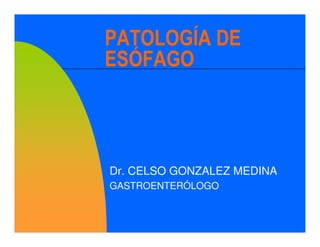 PATOLOGÍA DE
ESÓFAGO



Dr. CELSO GONZALEZ MEDINA
GASTROENTERÓLOGO
 